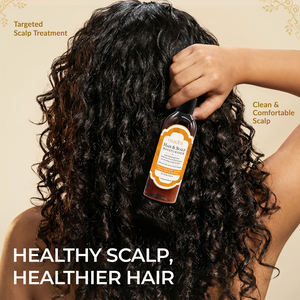 Hair & Scalp Moisturiser – Anti-Dandruff Care | 100 ml